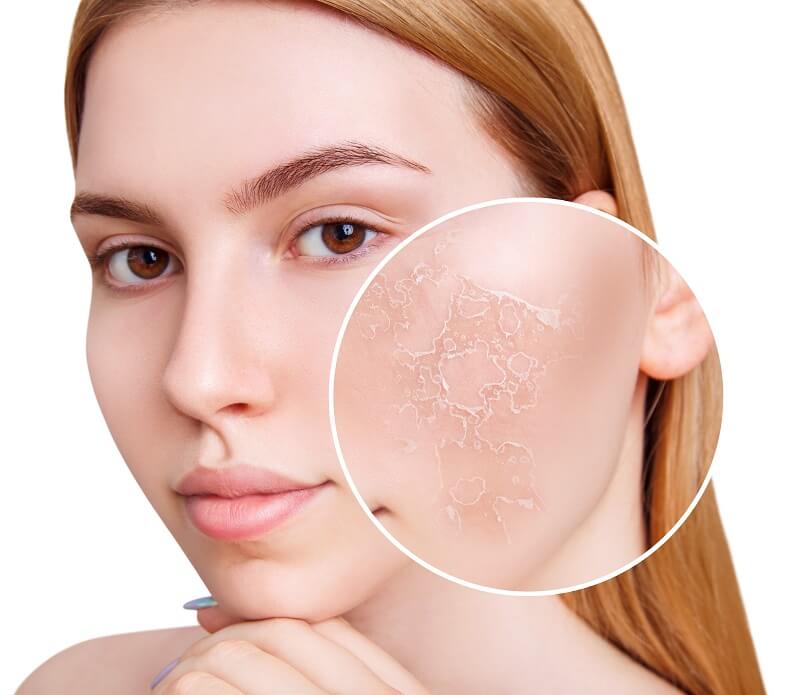 Da mặt khô nên dùng gì để không bị lão hóa sớm?